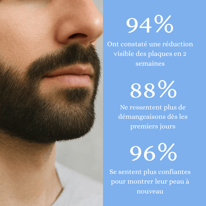 Crème apaisante anti démangeaisons & pellicules