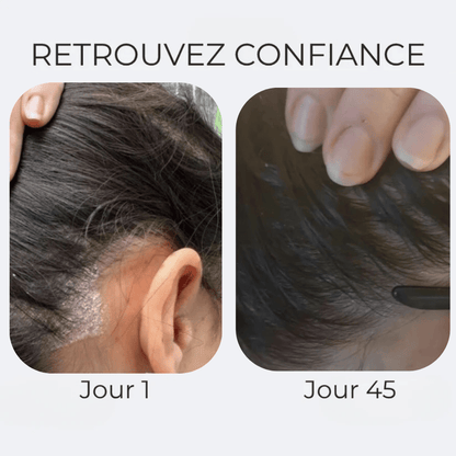 Crème apaisante anti démangeaisons & pellicules