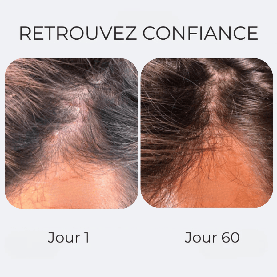 Crème apaisante anti démangeaisons & pellicules