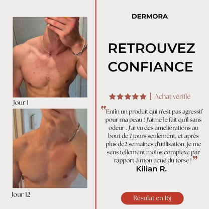 Sérum anti-Acné