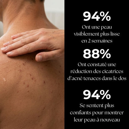 Sérum anti-Acné
